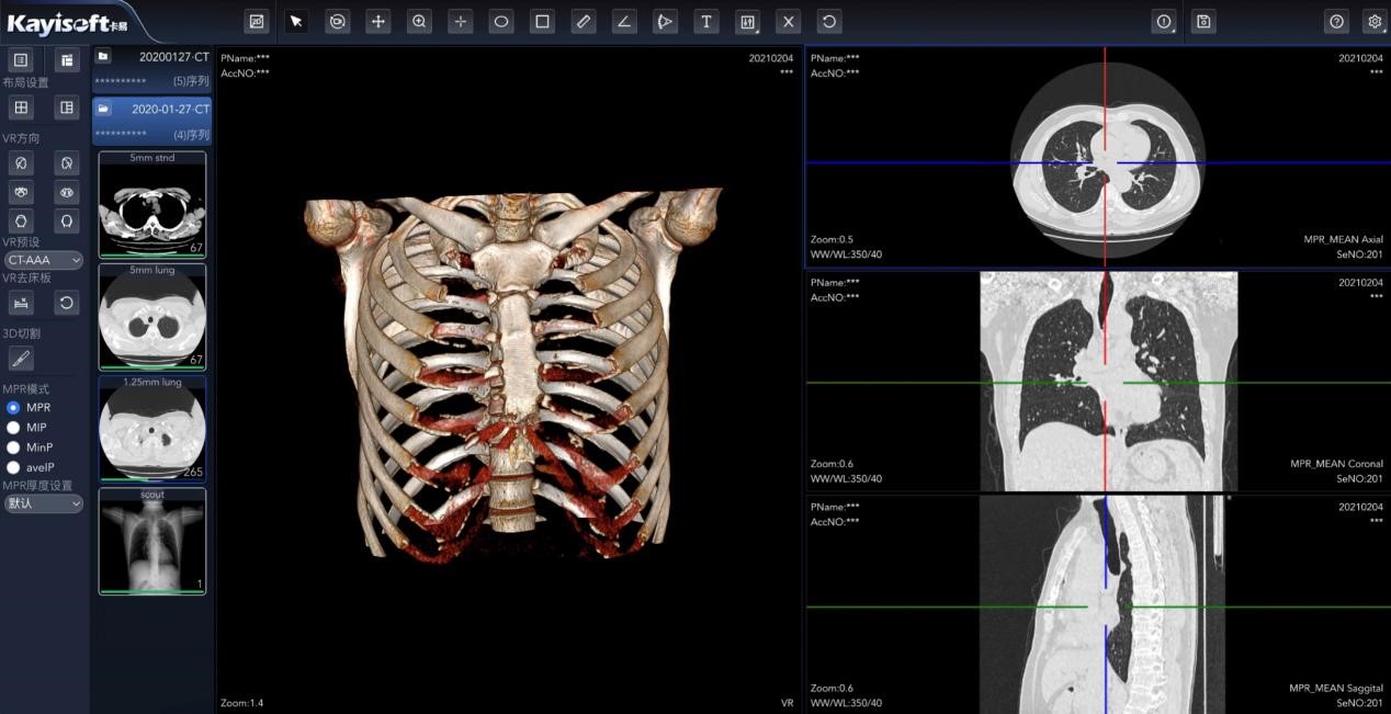 �Ŵ�������PACS