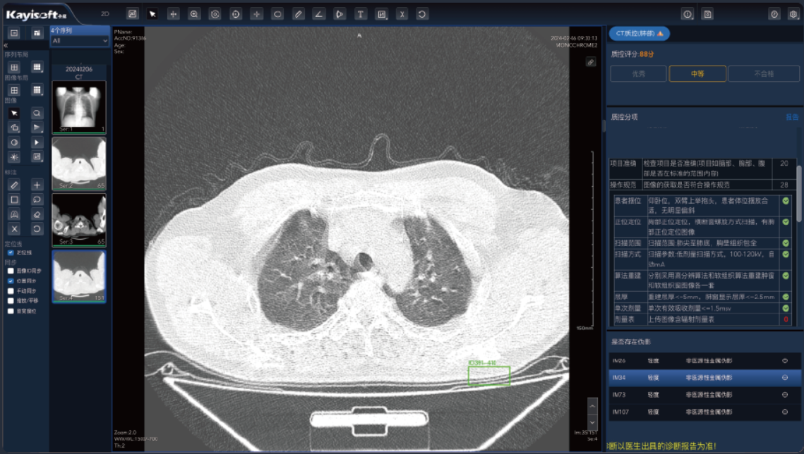 AIӰ���ʿؽ���ƻ�